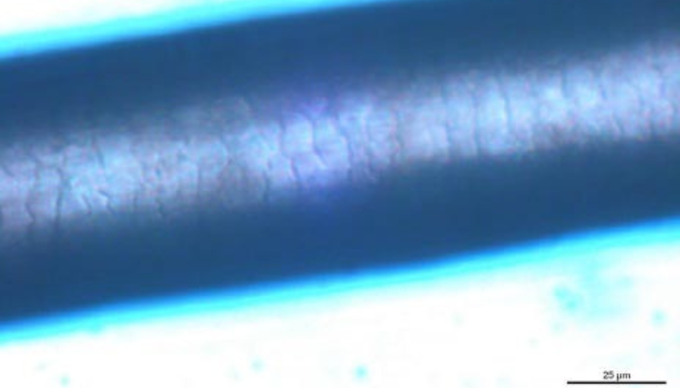 Hypogen vergrössertes Barthaar