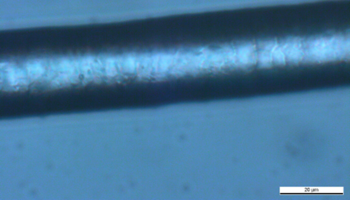 Hypogen Barthaar unbehandelt