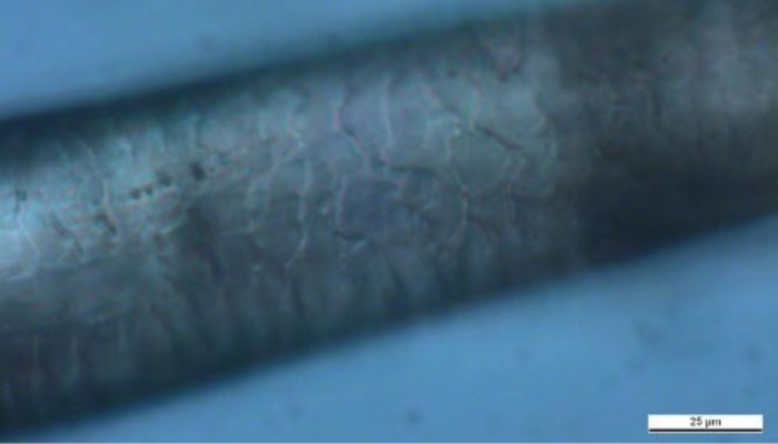 Hypogen Barthaar hoher ph Wert